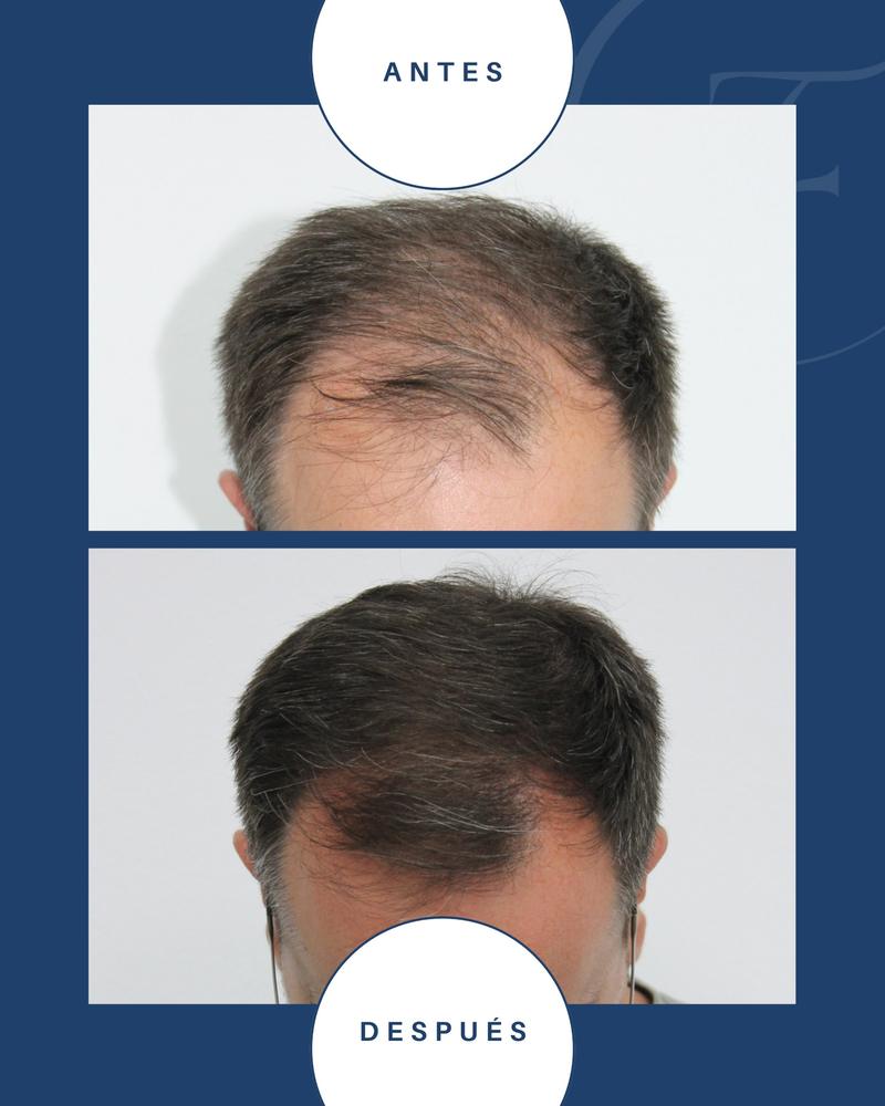 Caso clínico 1: fotografías antes y después